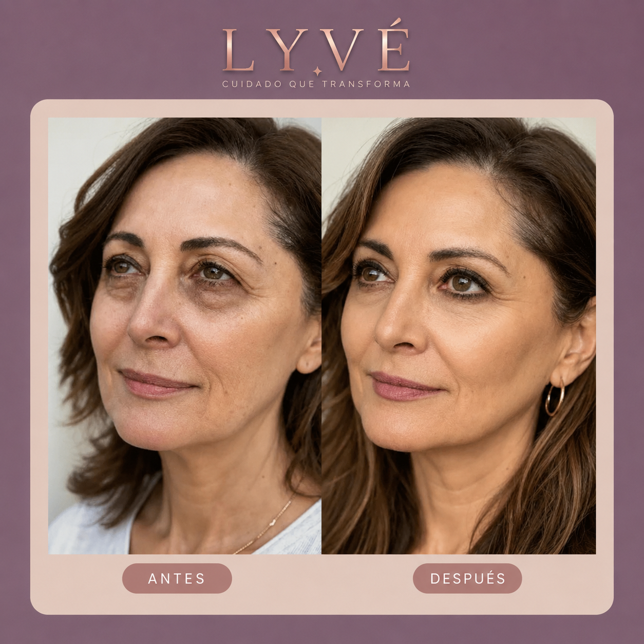 Tensor instantaneo para ojos | Disimula bolsas y arrugas mientras devuelve una apariencia fresca, firme y descansada.