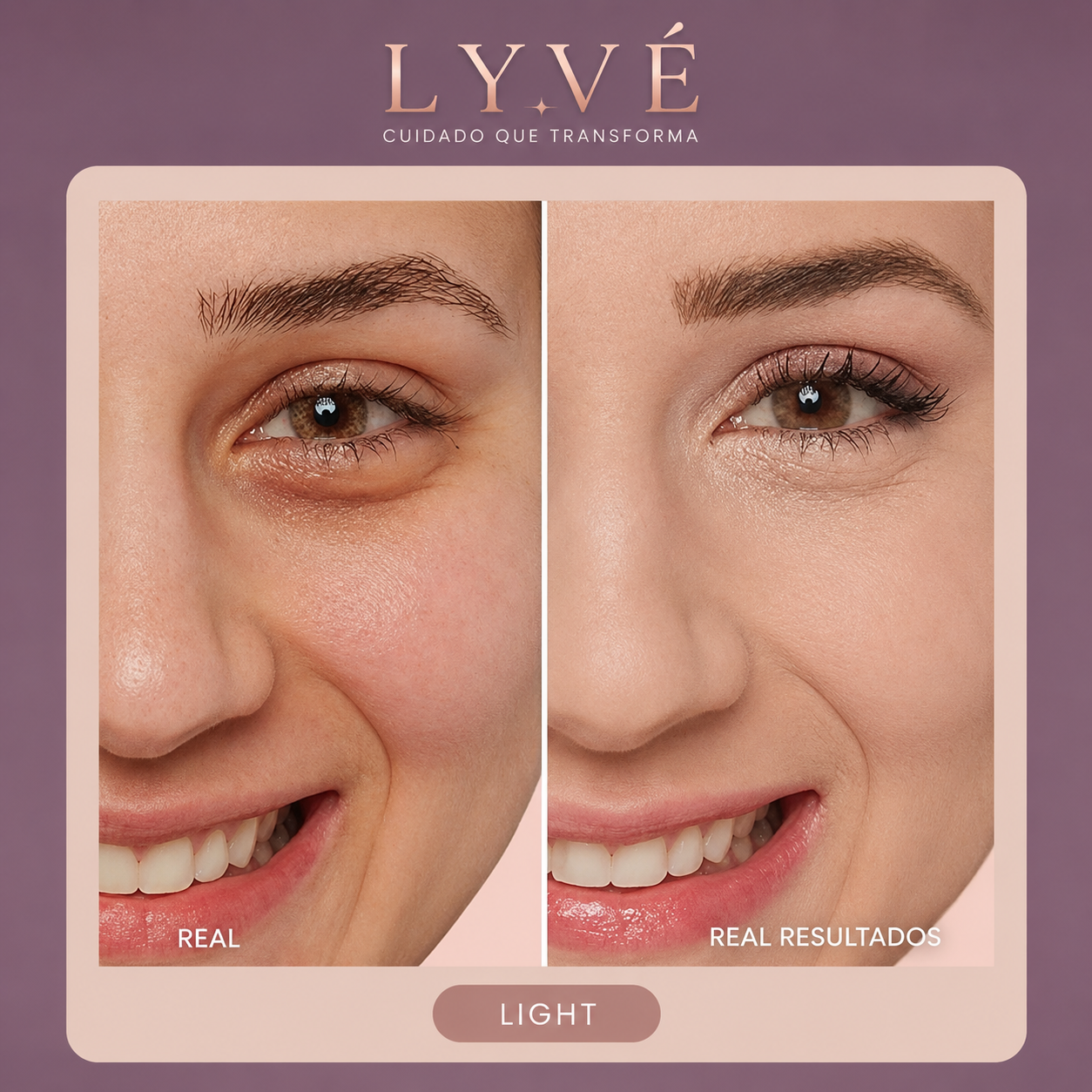 Tensor instantaneo para ojos | Disimula bolsas y arrugas mientras devuelve una apariencia fresca, firme y descansada.